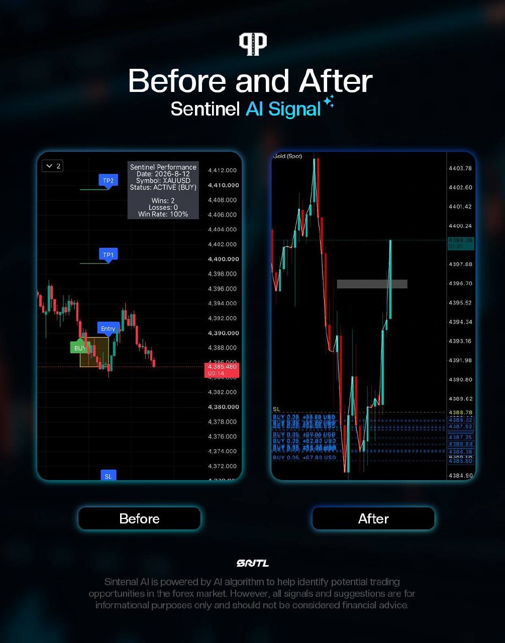 Sentinel AI Before/After 2